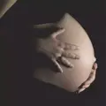 Bio arganový olej na strie